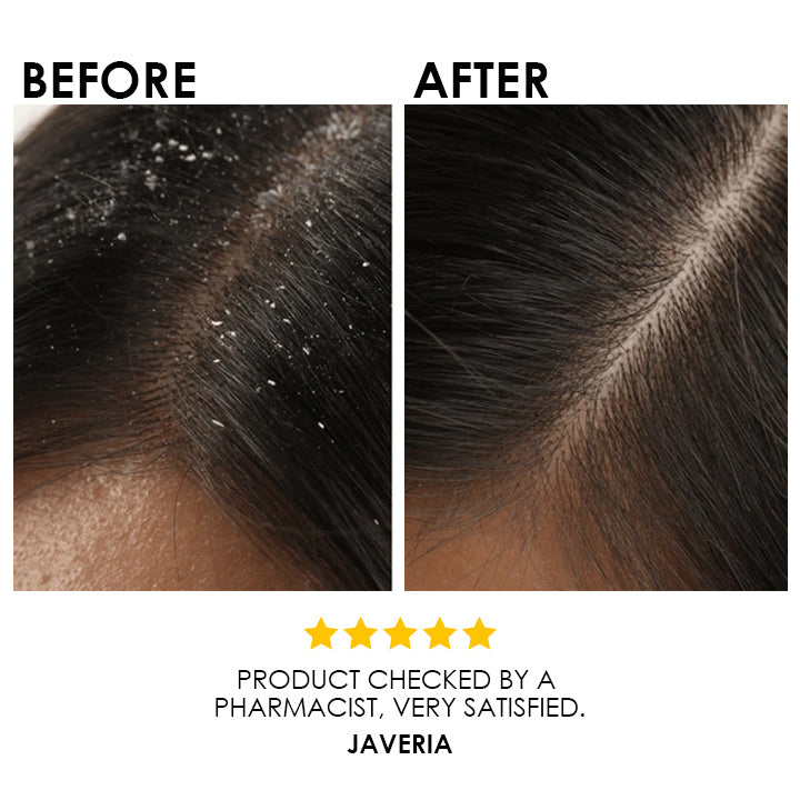 Blysmo Organic Hair Oil 30ml in Pakistan