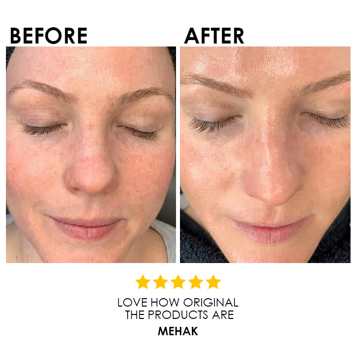 TEA TREE CLEANSER