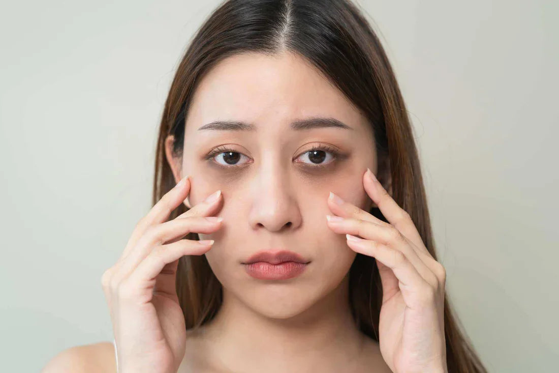Eye Care