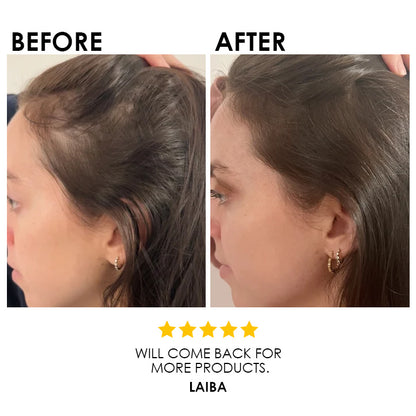 Blysmo Anti Hairfall Liquid Spray 100 Ml in Pakistan