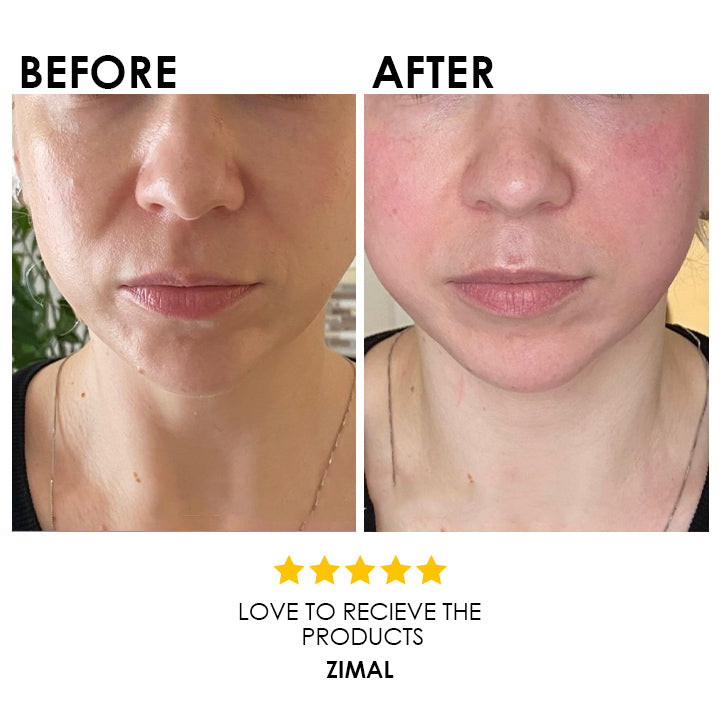 Blysmo Ha, Zinc, B3 Serum 30 Ml in Pakistan