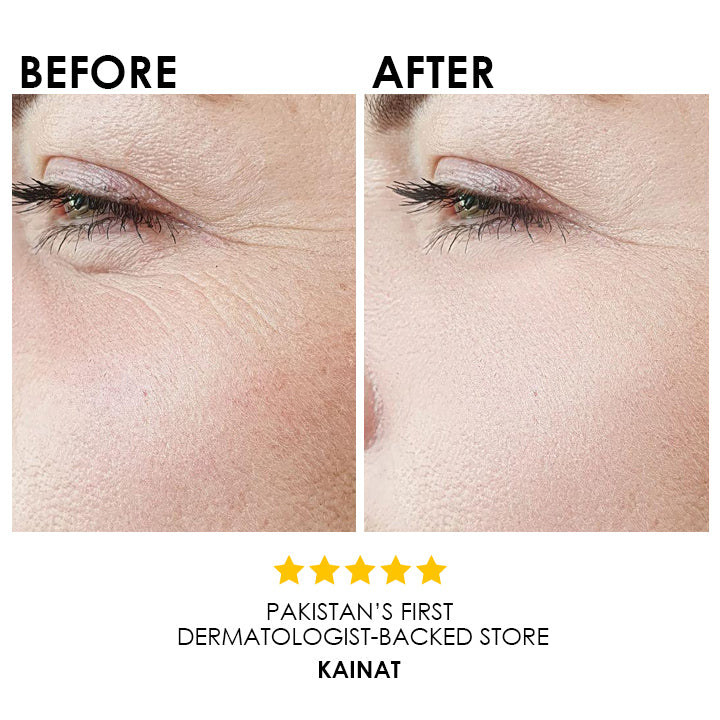 Blysmo Retinol Serum 30 Ml in Pakistan