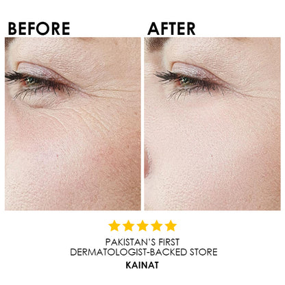 Blysmo Retinol Serum 30 Ml in Pakistan