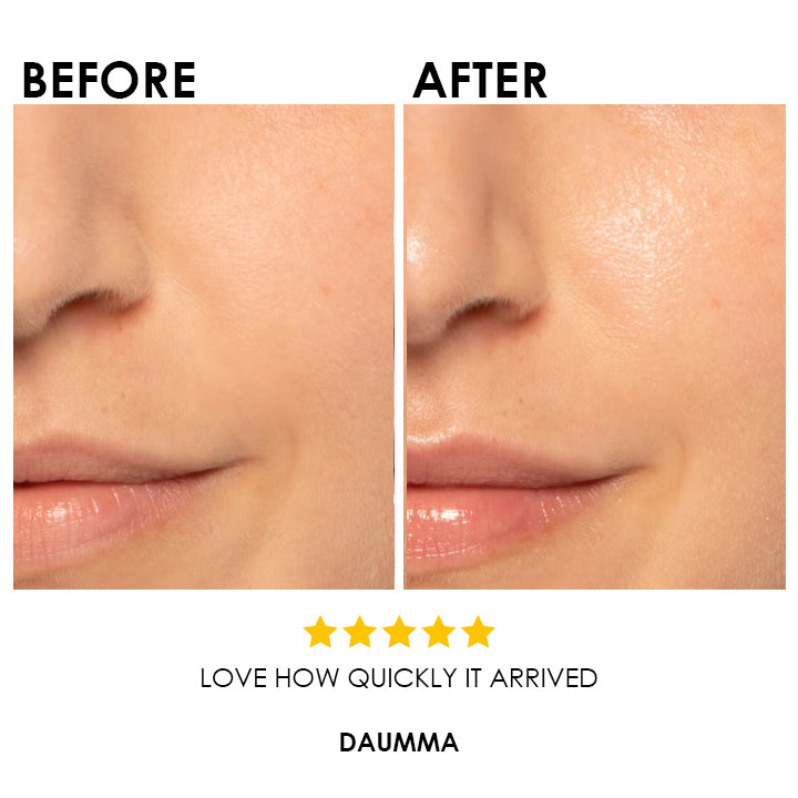 Blysmo Vitamin C Serum 30ml in Pakistan