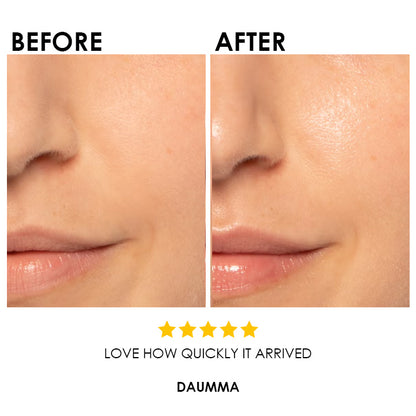 Blysmo Vitamin C Serum 30ml in Pakistan