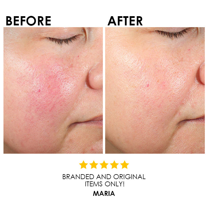 Blysmo Vitamin K Serum 30 Ml in Pakistan