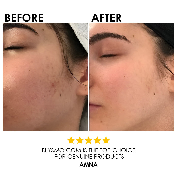 Blysmo Whitening Face Wash 100 Ml in Pakistan