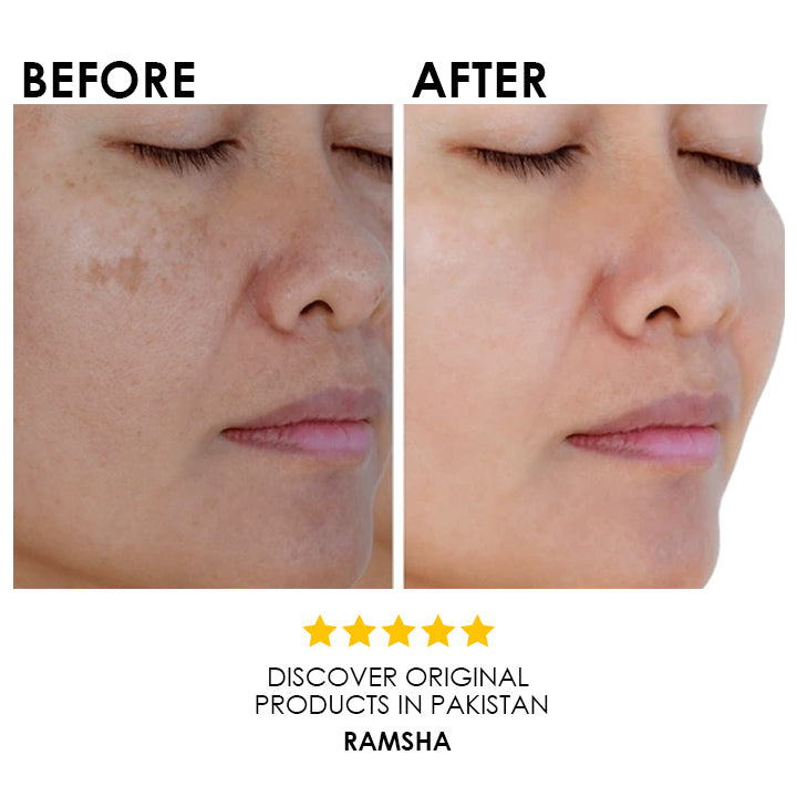 SKIN LIGHTENING SERUM